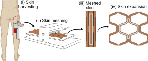 Skin Meshing Process